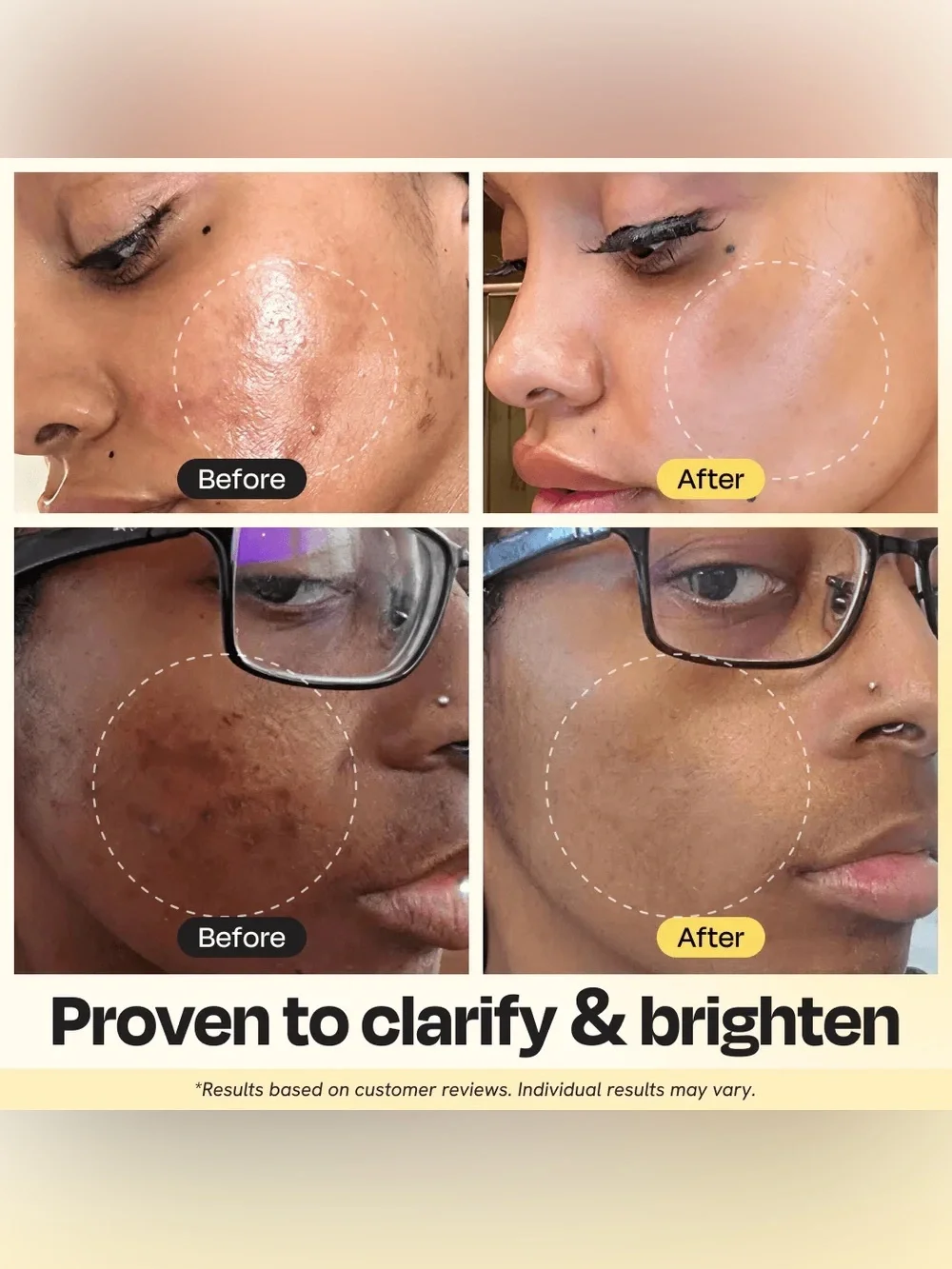Gleamin Vitamin C Treatment Mask with Applicator Brush
